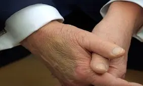 ترامپ استفاده از آسپرین را دلیل کبودی دست خود معرفی کرد