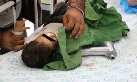 چرخ گوشت انگشتان دختربچه ٢ ساله را بلعید
