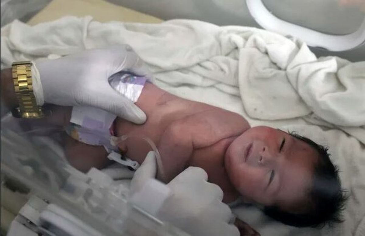 حمله مسلحانه به بیمارستان محل بستری نوزاد متولدشده در زیرآوار در سوریه