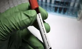 نشانگرهای آسیب مغزی مبتلایان به ویروس کرونا بیشتر از مبتلایان به آلزایمر است