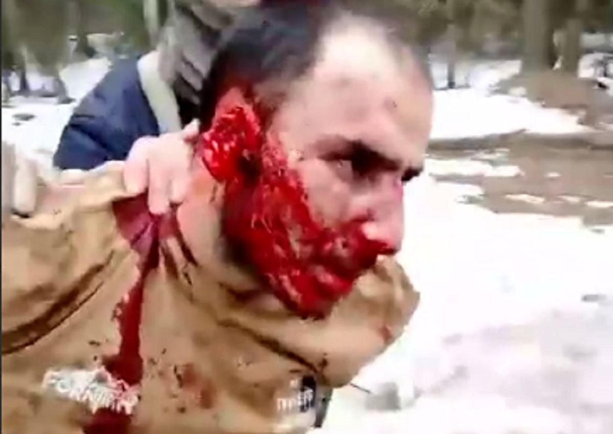  بازداشت سومین عامل حمله تروریستی در مسکو با چهره ای خون آلود/ ویدئو