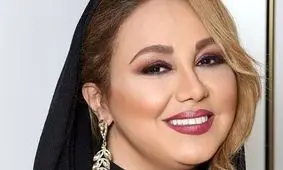 تغییر چهره عجیب بهنوش بختیاری سوژه فضای مجازی شد/ عکس