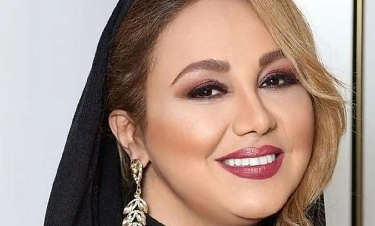 تغییر چهره عجیب بهنوش بختیاری سوژه فضای مجازی شد/ عکس