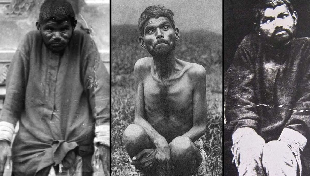 دینا سانیچار؛ پسری وحشی که واقعا با «گرگها» بزرگ شده بود