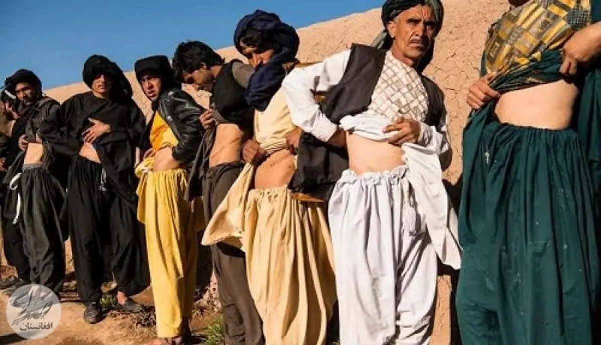 مردم افغانستان مجبور به فروش کلیه‌های خود شده‌اند