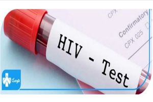 همه چیز در مورد آزمایش ایدز