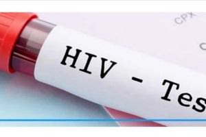 همه چیز در مورد آزمایش ایدز