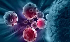 کاهش رشد تومورهای سرطانی با برخی رژیم های غذایی