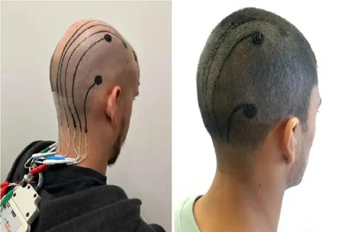 خالکوبی بر سیستم ایمنی بدن چه تاثیری دارد؟
