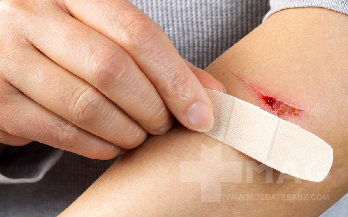 کمبود کدام ویتامین باعث تاخیر در بهبود زخم ها میشود؟