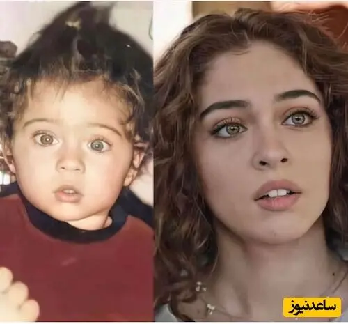 جمره بایسل 