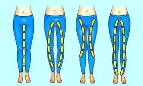 آیا پای پرانتزی منجر به کمر درد می شود؟