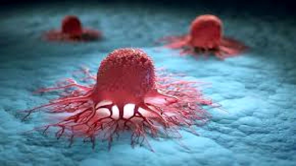 کدام نوع از سرطان ها قابل پیشگیری هستند؟