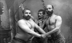  بیماری «هالوکس والگوس» در زمان قاجار!/ عکس