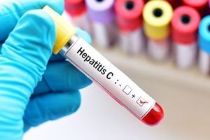 درمان رایگان بیماران هپاتیت C؟