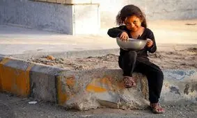 سوء‌تغذیه در کودکان؛ ۳۰۰ هزار نفر مشمول حمایت می‌شوند

