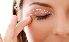 روش های تخلیه چربی پشت پلک