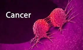 انتشار جدول جهانی شیوع سرطان ها در کشورها/ ایران به کدام نوع از سرطان شناخته شده است؟