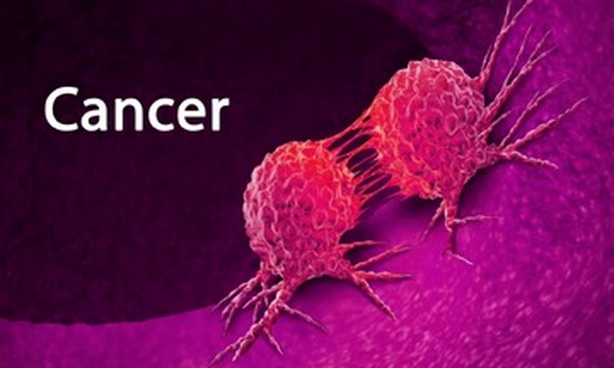 انتشار جدول جهانی شیوع سرطان ها در کشورها/ ایران به کدام نوع از سرطان شناخته شده است؟