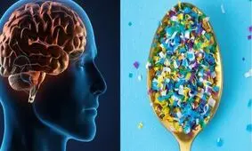 ریزپلاستیک‌ها چند درصد مغز ما را اشغال کرده‌اند؟

