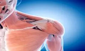 رفع درد شانه به روشی جدید