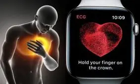 واردات اپل واچ دردسرساز شد