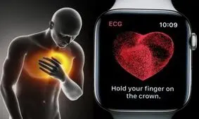 واردات اپل واچ دردسرساز شد