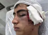 ورود دادستانی بم به پرونده تنبیه بدنی دانش آموز در دهبکری