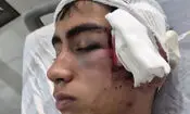 ورود دادستانی بم به پرونده تنبیه بدنی دانش آموز در دهبکری