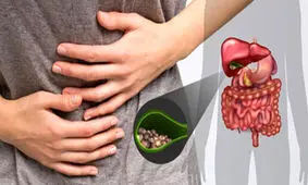 مبتلایان به سنگ کیسه صفرا ببینند!