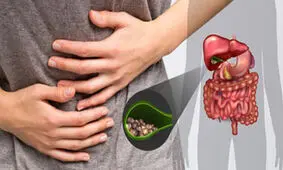 مبتلایان به سنگ کیسه صفرا ببینند!