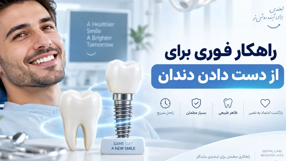 راهکار فوری برای از دست دادن دندان: چرا ایمپلنت دندان دیگر یک انتخاب لوکس نیست؟