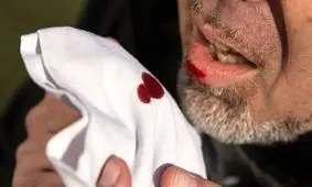 سرفه بیش از ۲ هفته را جدی بگیرید

