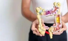 تشخیص سرطان روده بزرگ به کمک نوعی آزمایش خون جدید ممکن شد