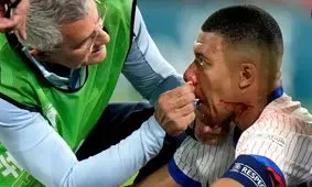 بیم و امید خروس‌ها در یورو ۲۰۲۴؛ آنچه درباره بینی شکسته امباپه می‌دانیم

