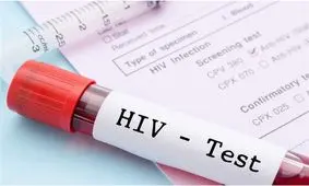 آخرین وضعیت HIV در ایران؛ نیمی از مبتلایان در سنین ۲۵ تا ۳۹ سال