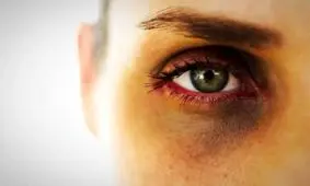 سیاهی دور چشم نشانه چه بیماری است؟