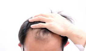 درمان ریزش مو با کراتین

