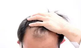 درمان ریزش مو با کراتین

