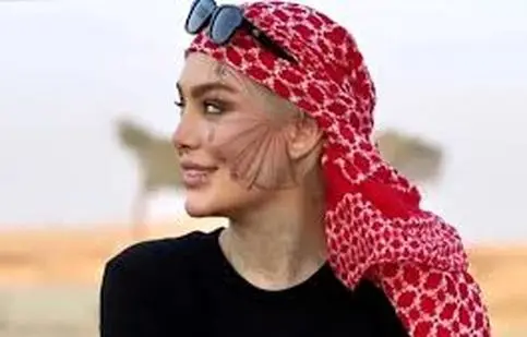 ویدئوی جدیدی که سحر قریشی منتشر کرد/ چه بلایی سر خودش آورده است