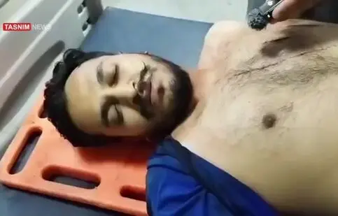 توضیحات یکی از مجروحان حمله تروریستی راسک/ ویدئو

