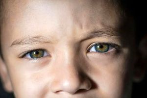 تشخیص اوتیسم در کودکان با یک آزمایش ساده چشم