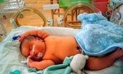 تولد نوزاد ۶ کیلوگرمی در میاندوآب