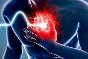 حمله قلبی چیست، چه علائمی دارد و چطور می‌توان از آن پیشگیری کرد؟

