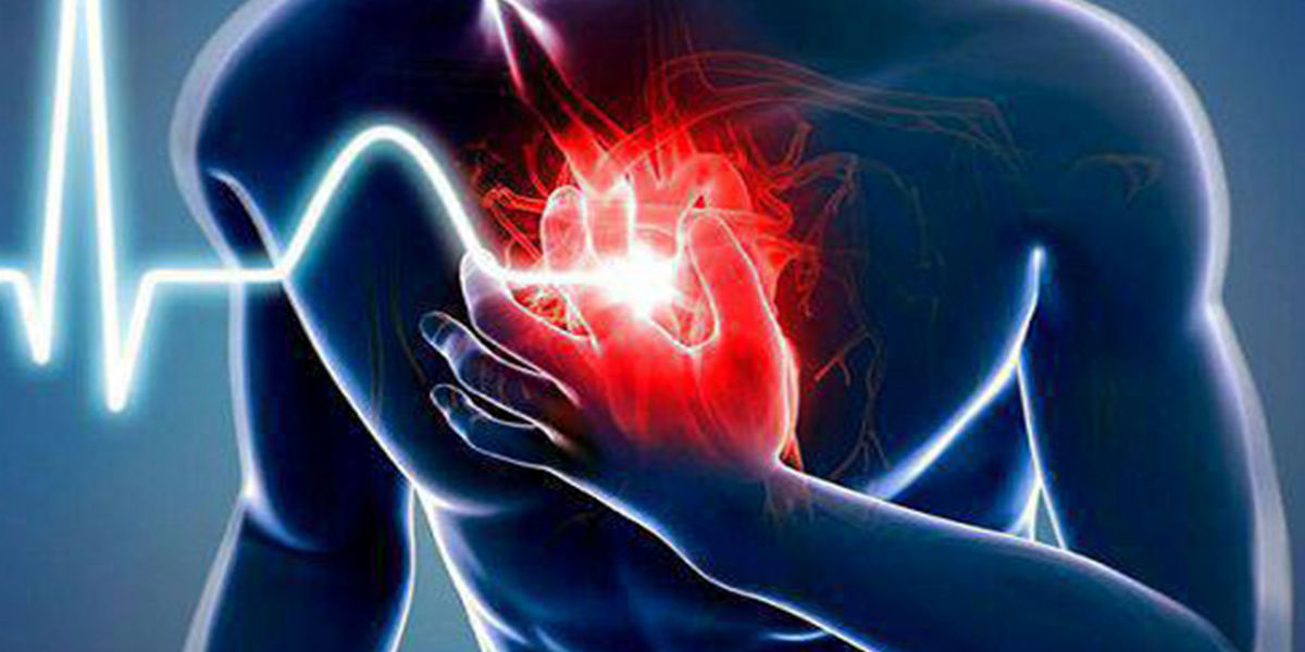حمله قلبی چیست، چه علائمی دارد و چطور می‌توان از آن پیشگیری کرد؟

