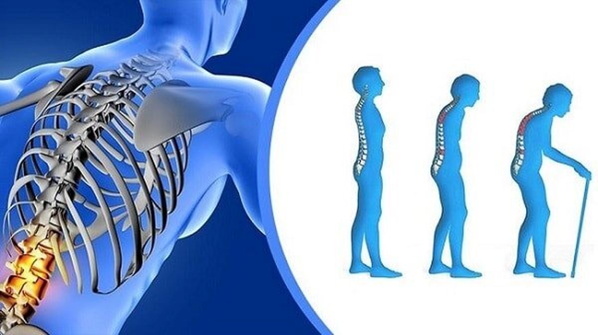 چرا با افزایش سن، وضعیت سلامت استخوان ها بدتر میشود؟