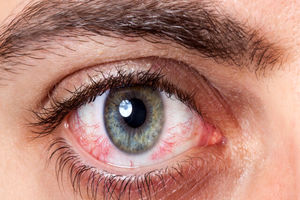 ۶ عفونت‌ چشمی که می‌توانند عواقب فاجعه باری داشته باشند