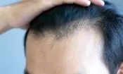 عارضه جانبی نگران‌کننده داروهای لاغری که هیچ‌کس در مورد آن صحبت نمی‌کند