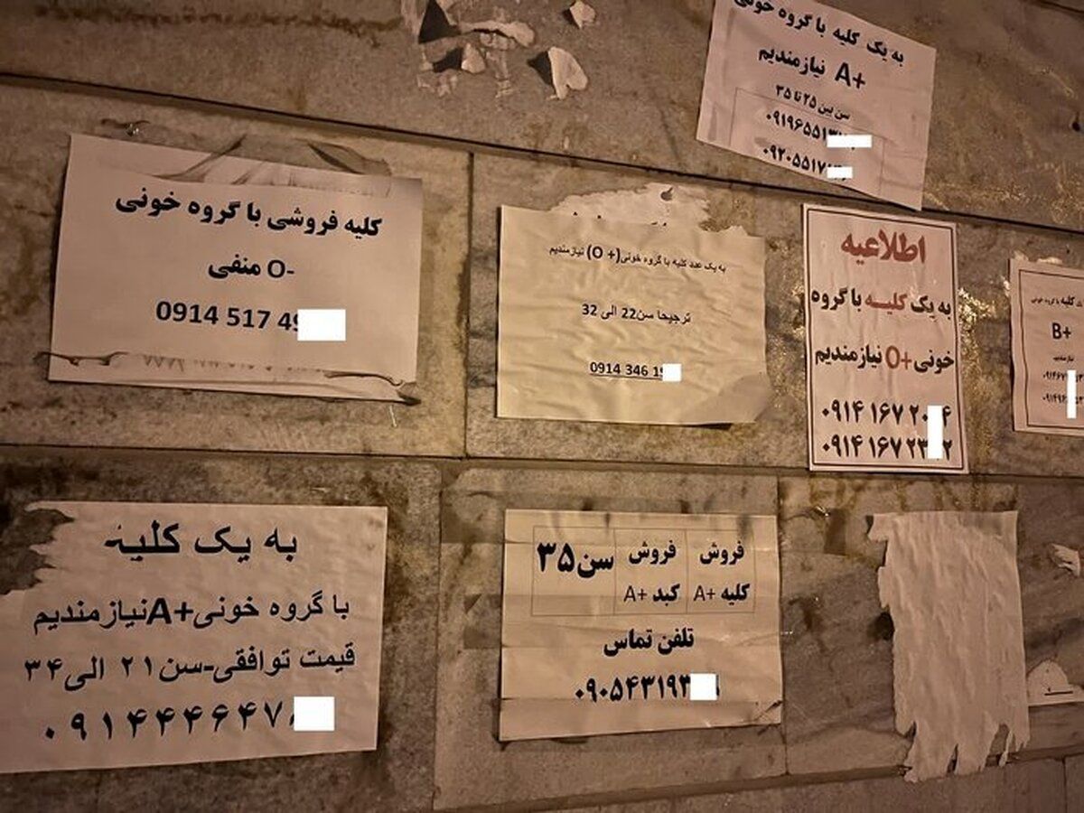  فروش دلاری «کلیه» ایرانی‌ها با سفر به ترکیه و عراق!/ مصاحبه با خانمی که کلیه اش را فروخته است