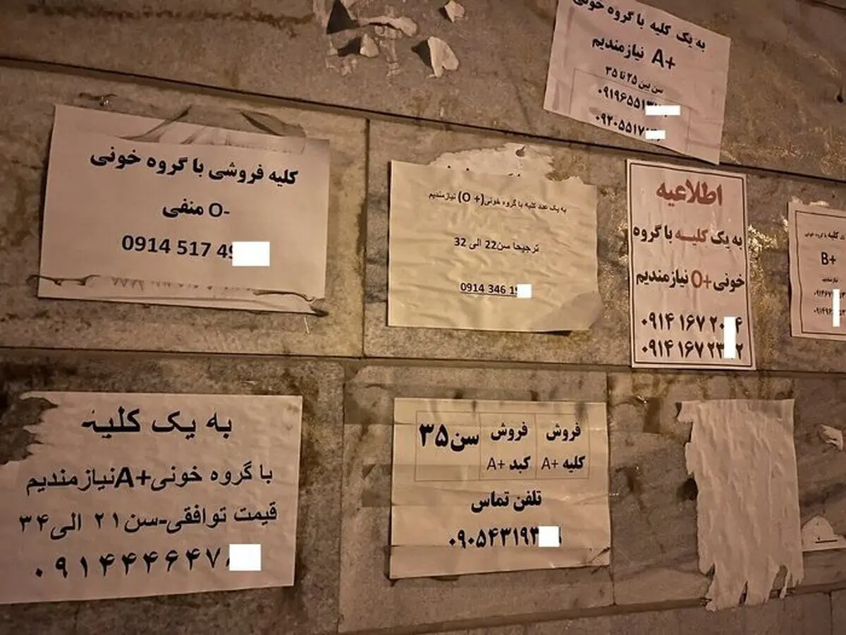  فروش دلاری «کلیه» ایرانی‌ها با سفر به ترکیه و عراق!/ مصاحبه با خانمی که کلیه اش را فروخته است